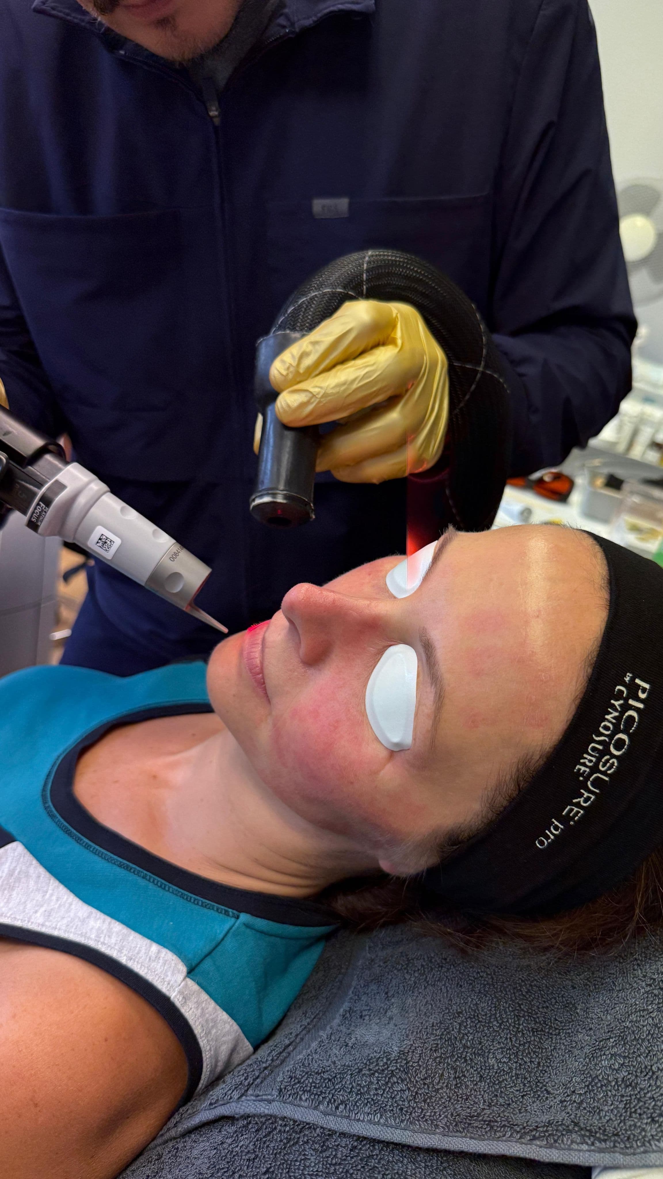 SofWave Skin Tightening