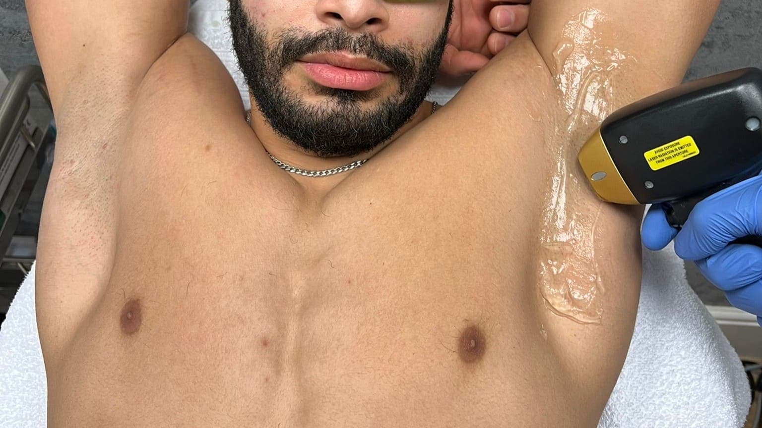 Hair Removal