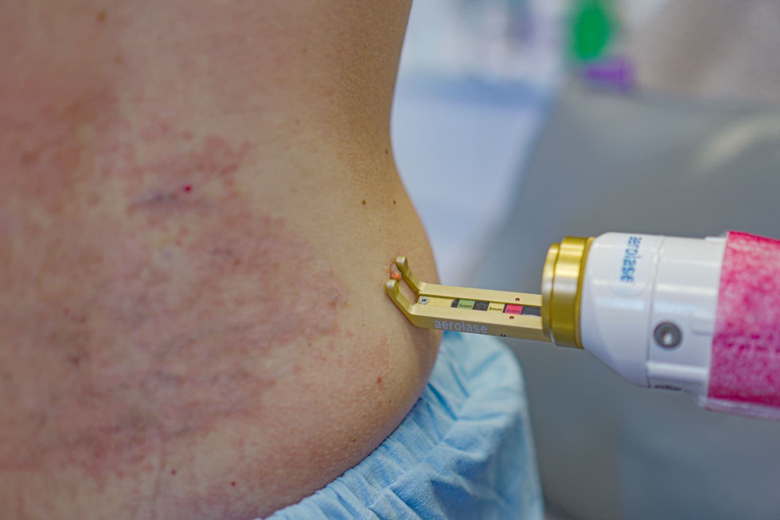 Skin Condition Treatment